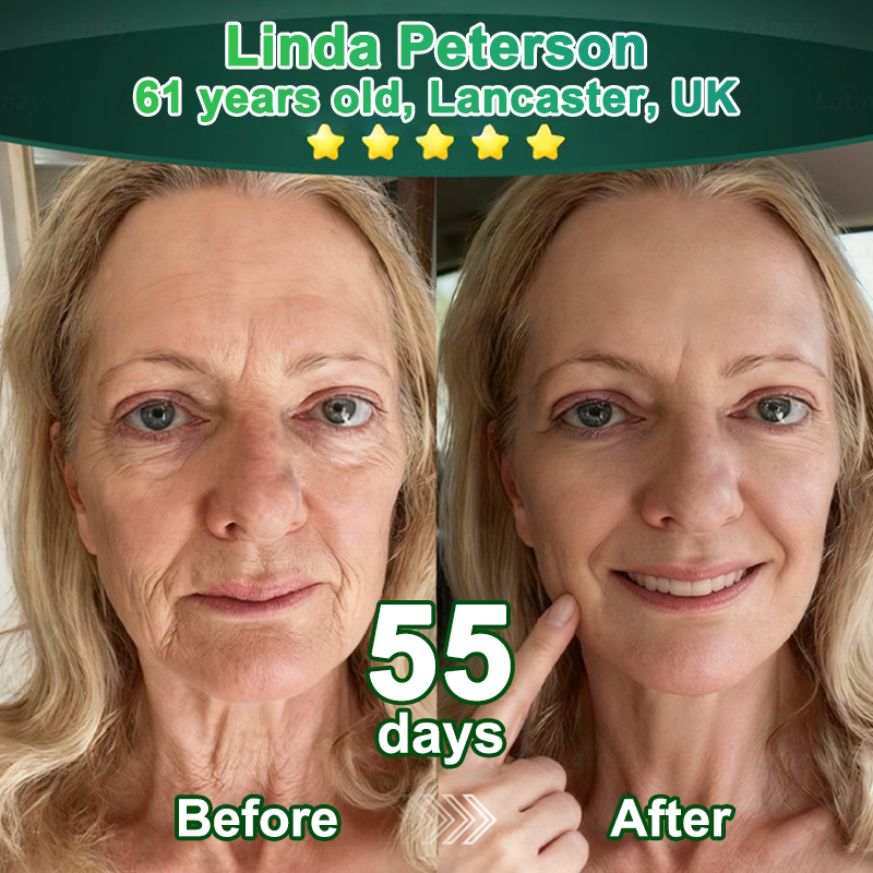 💖Change from the inside out | Purelora® Stem Cell–Derived EGF & Copper Peptide Activating Serum  (Deeply activates skin renewal from within for firmer, smoother-looking skin)