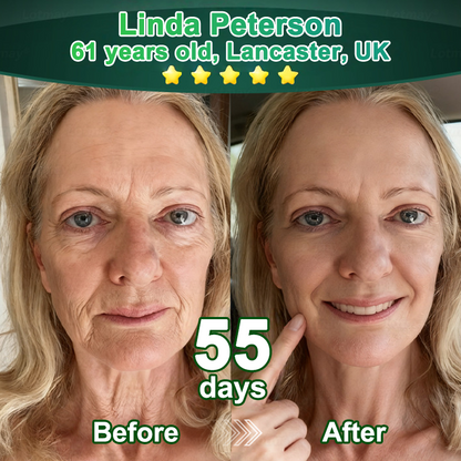💖Change from the inside out | Purelora® Stem Cell–Derived EGF & Copper Peptide Activating Serum  (Deeply activates skin renewal from within for firmer, smoother-looking skin)