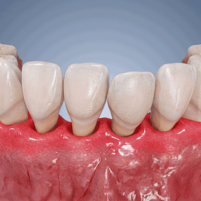 💎Purelora® GumRevive Periodontal Repair Gel