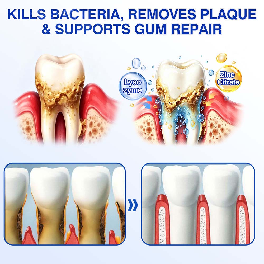 💎Purelora® GumRevive Periodontal Repair Gel