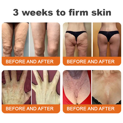 "Made and Shipped from UK|✅ Official Store✨Purelora® Bee Venom Skin Restorative Cream 🔥 LAST DAY 80% OFF 💎"