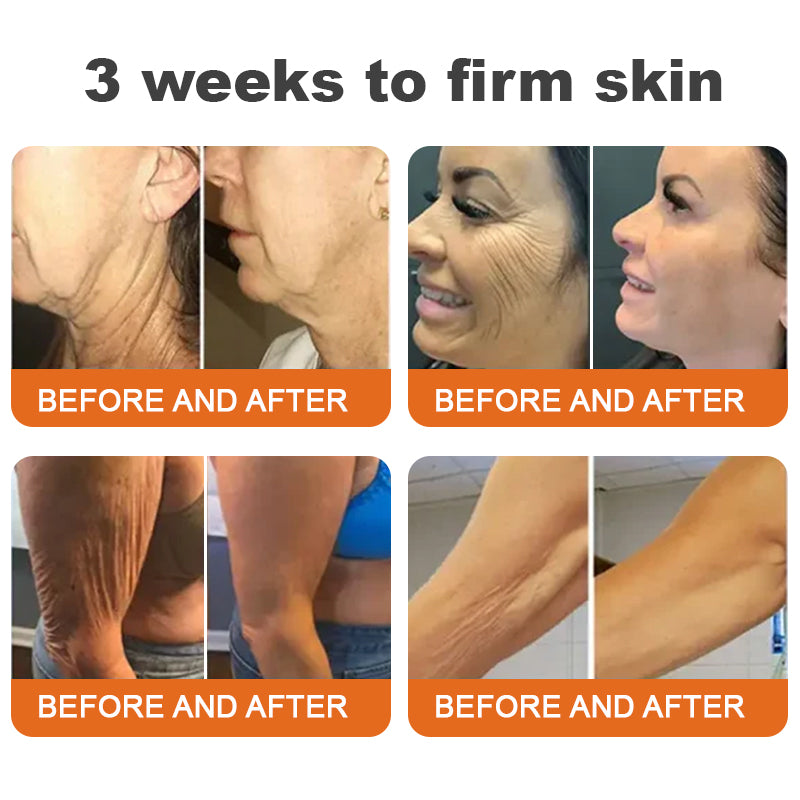 "Made and Shipped from UK|✅ Official Store✨Purelora® Bee Venom Skin Restorative Cream 🔥 LAST DAY 80% OFF 💎"