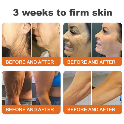 "Made and Shipped from UK|✅ Official Store✨Purelora® Bee Venom Skin Restorative Cream 🔥 LAST DAY 80% OFF 💎"