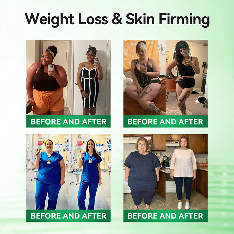 𝑶𝒇𝒇𝒊𝒄𝒊𝒂𝒍 𝑺𝒕𝒐𝒓𝒆 | 👩‍⚕️ H𝐞a𝐥r𝐢z𝐞® 1𝟐-𝐈N-1 M𝐨r𝐢n𝐠a * B𝐞r𝐛e𝐫i𝐧e * N𝐀D+ 𝐀d𝐯a𝐧c𝐞d N𝐚n𝐨 𝐌i𝐜r𝐨n𝐞e𝐝l𝐞 𝐏a𝐭c𝐡 (𝐎𝐧𝐜𝐞 𝐃𝐚𝐢𝐥𝐲, 𝐯𝐢𝐬𝐢𝐛𝐥𝐞 𝐜𝐡𝐚𝐧𝐠𝐞𝐬 𝐢𝐧 𝟕 𝐝𝐚𝐲𝐬）🚀F𝐨r 𝐎𝐛𝐞𝐬𝐢𝐭𝐲, 𝐋o𝐨s𝐞 𝐒k𝐢n, 𝐃𝐢𝐚𝐛𝐞𝐭𝐞𝐬, 𝐒𝐥𝐞𝐞𝐩 𝐀𝐩𝐧𝐞𝐚, 𝐀𝐧𝐝 𝐉𝐨𝐢𝐧𝐭 𝐈𝐬𝐬𝐮𝐞𝐬 , 𝐉𝐨𝐢𝐧𝐭 𝐈𝐬𝐬𝐮𝐞𝐬 𝐀𝐧𝐝 m𝐨r𝐞🚀
