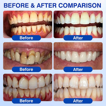 💎Purelora® GumRevive Periodontal Repair Gel